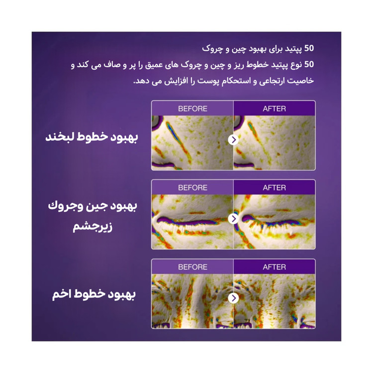 اسنس بایو لیفتینگ و جوانساز نامبر 9 نامبوزین
