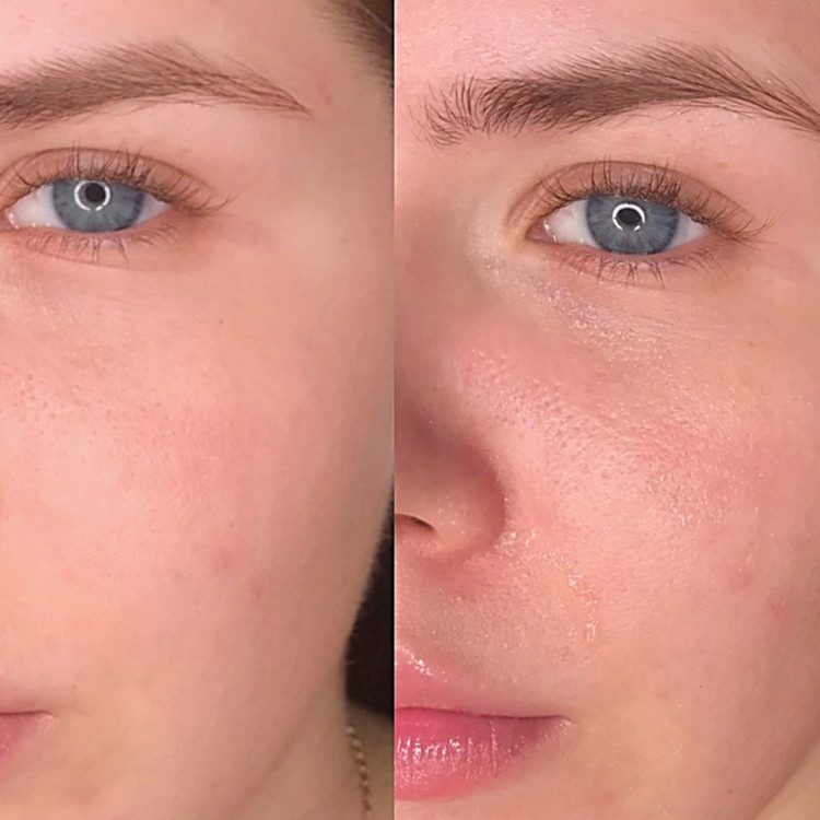 آمپول سنتلا ماداگاسکار SKIN1004 آبرسان و ترمیم کننده